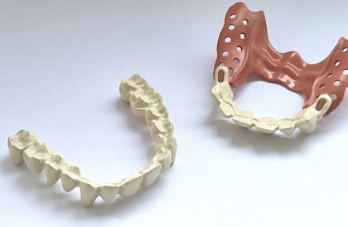 Evonik introduces two PEEK grades for long-term dental prosthetics